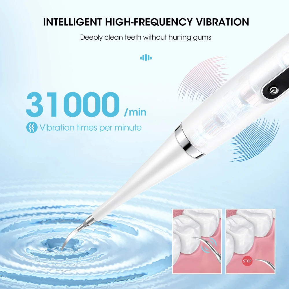 Electric Teeth Whitening Scaler – High-Frequency Tooth Cleaner Dental Plaque Tartar Remover with 5 Modes