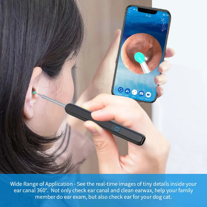 Smart Visual Ear Cleaner with HD Camera & LED Lights | Safe & Precise Ear Wax Removal